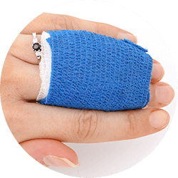 Finger injuries