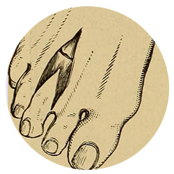 Image of a foot