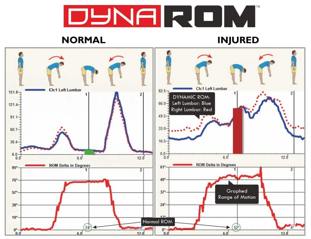 dynarom evaluation in denver by a chiropractor